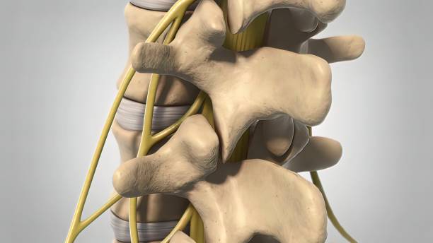 La presión sobre las raíces nerviosas causada por la médula espinal y la degeneración pueden ser causadas por lo siguiente.  Discos deslizados o herniados.